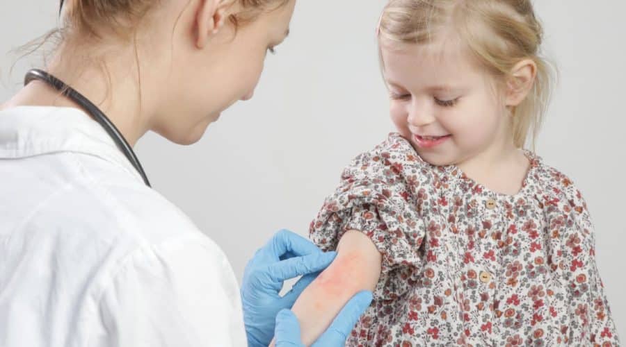 Dermatología infantil en Valencia | enfermedades dermatologicas en ninos